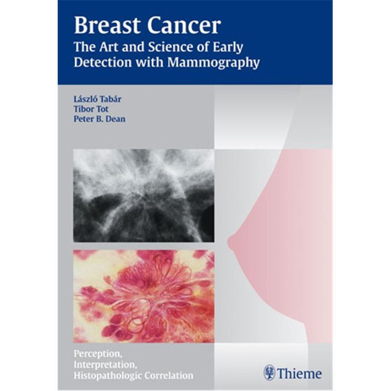 Breast Cancer - The Art and Science of Early Detection with Mammography - Perception, Interpretation, Histopathologic Correlatio